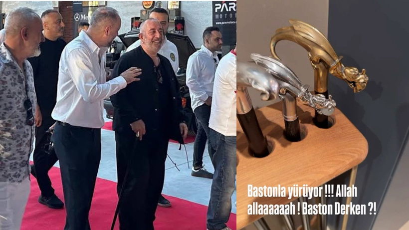 Cem Yılmaz’ın bastonlu görüntülerine yanıt: Baston derken!?
