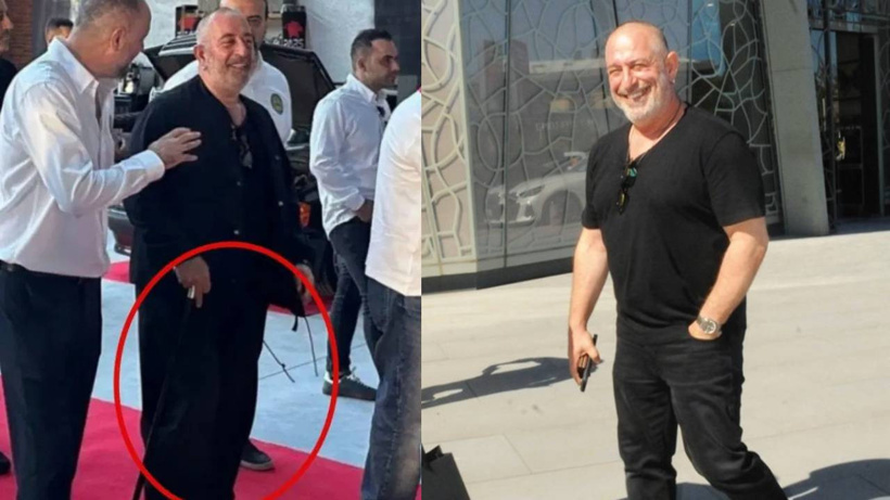 Cem Yılmaz'ın son hali ortaya çıktı: Bastonu attı!