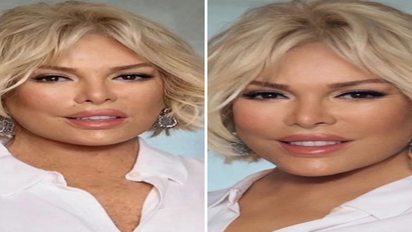 Görenler Tanıyamadı! Ajda Pekkan Estetiklere Doymadı