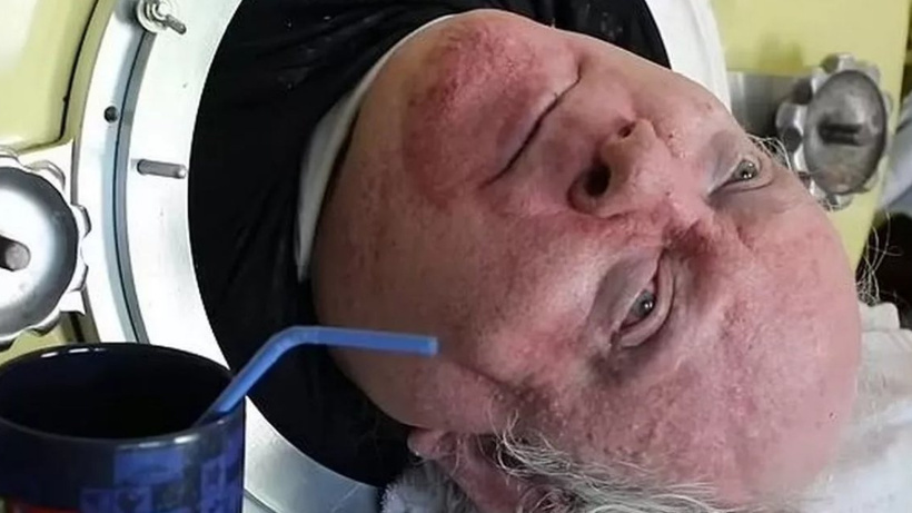 Demir Akciğerle 70 Yıl Nasıl Yaşadı ve Avukat Oldu: Paul Alexander'ın İnanılmaz Hikayesi