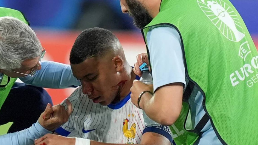 Mbappe'nin Son Durumu Belli Oldu! Kalan Maçlarda Forma Giyebilecek mi?