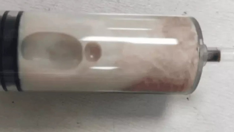 Vücudundan beyaz kan aktı. Doktor sebebini açıkladı