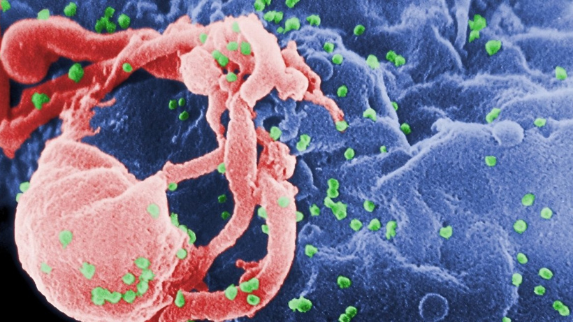 Bir hasta daha HIV'den kurtuldu