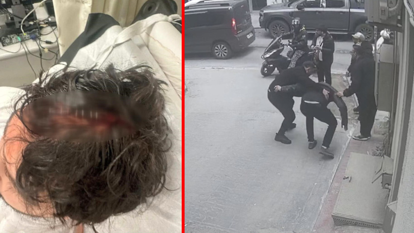 Kaza mı ihmal mi? Kaldırımda yürürken başına cam düştü! 7 dikiş atıldı - Resim : 3