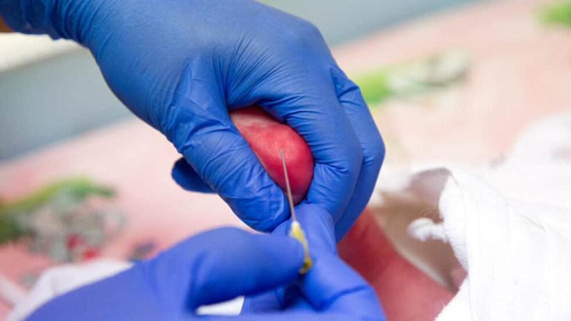 Bir damlası ömür boyu hastalığı engellemeye yarıyor! Aileler bebeklerine test yaptırmaktan kaçıyor - Resim : 2