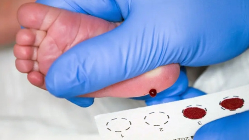 Bir damlası ömür boyu hastalığı engellemeye yarıyor! Aileler bebeklerine test yaptırmaktan kaçıyor - Resim : 4
