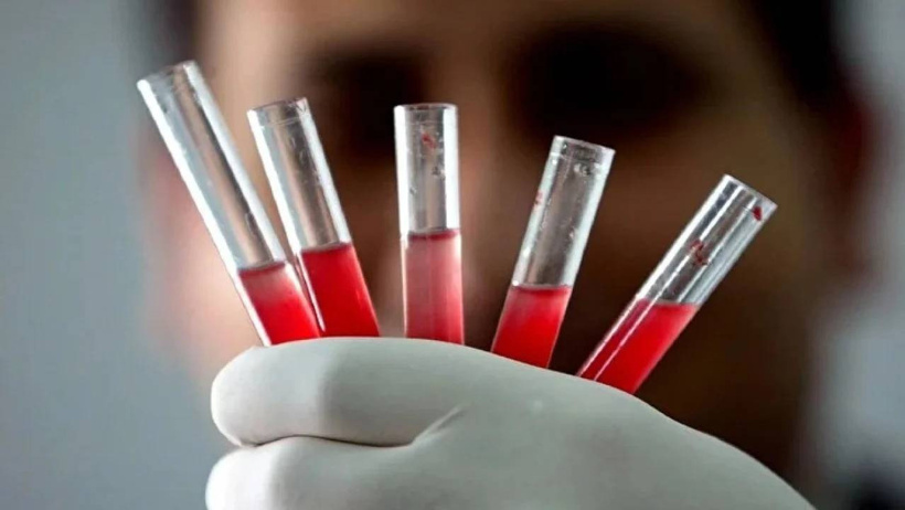 Kenelerin sevmediği kan grubu: Bu insanlar çok şanslı! - Resim : 2