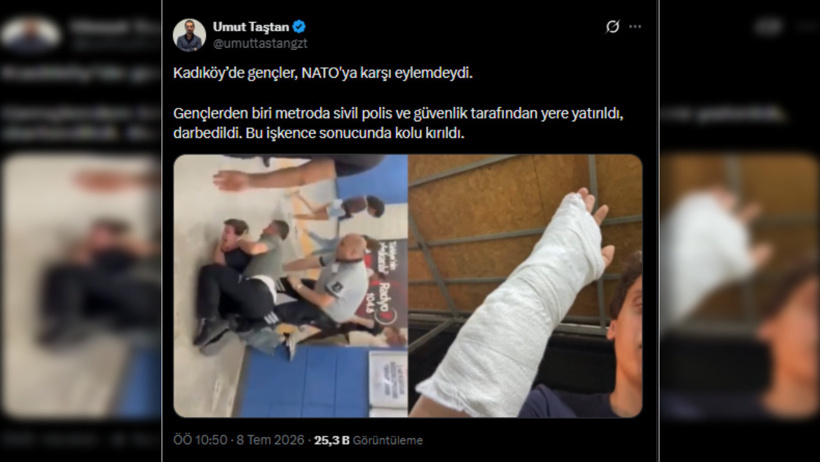 NATO karşıtı eyleme katılan gencin kolu kırıldı - Resim : 3