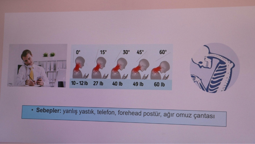 Uzman isimden korkutan uyarı: Farkında olmadan boynunuza 25 kilo yüklüyorsunuz - Resim : 2