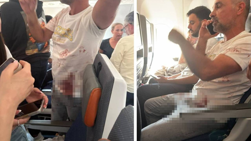 Son Dakika | İsrail uçağında pilotlar birbirini bıçaklamış - Resim : 2
