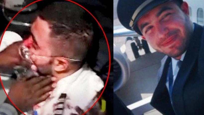 Terörist pilot baltayla saldırmış! - Resim : 3
