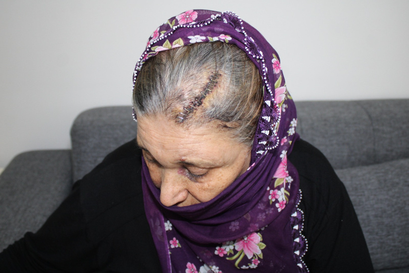Engelli kızı için rampa isteyen kadına kürekle saldırdı: Seni öldürüp leşini köpeklere yediririm - Resim : 2