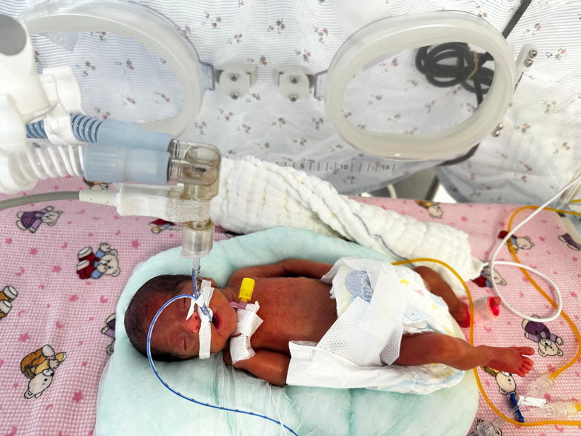 650 gram doğmuştu: Leyla bebek 4 aylık yaşam savaşını kazandı - Resim : 1